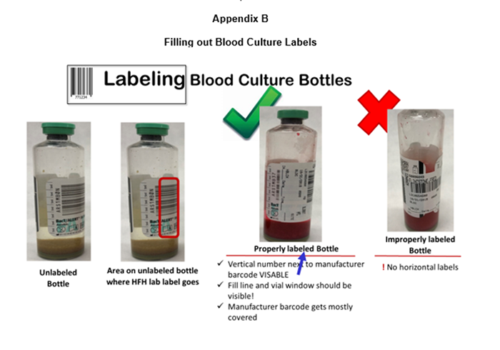 how to draw blood cultures x2 - Almeda Cullen